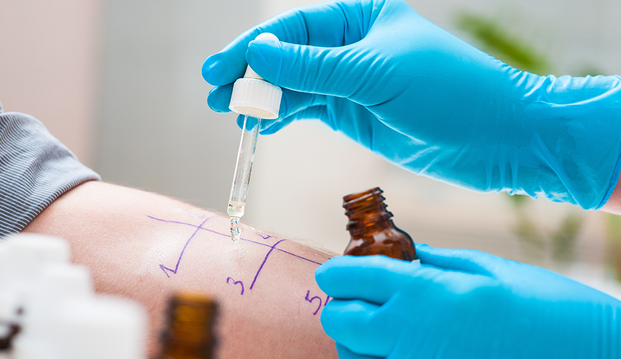 UKM Hautklinik | Allergologie